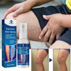 Varicose Veins Spray